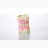 Новая модель детской челюсти с зубами